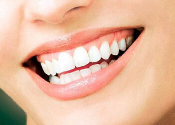 evde diş beyazlatma yöntemleri