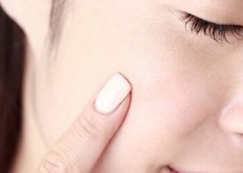 sivilceli ciltler için pratik öneriler