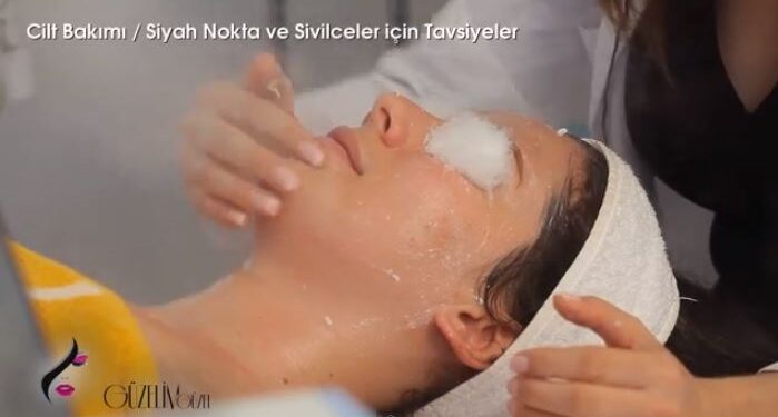 temel cilt bakımı 05(buhar uygulaması)